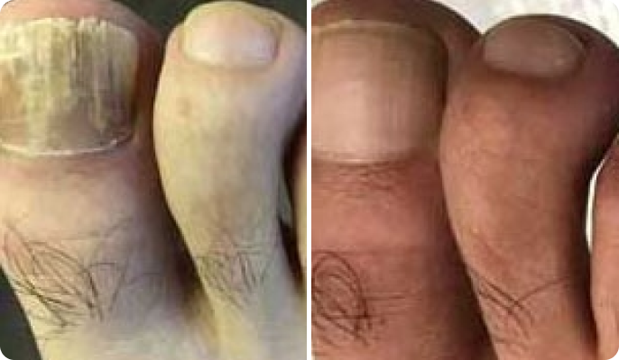 James Rodriguez before after