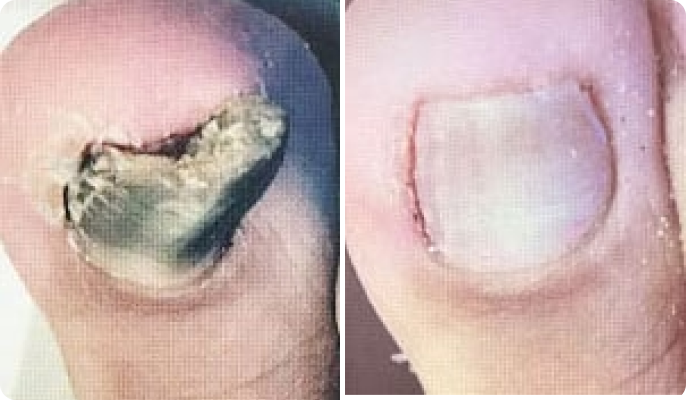 Patricia O'Brien before after