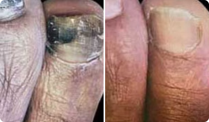 Angela Foster before after